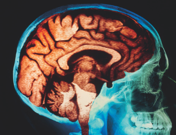 a brain